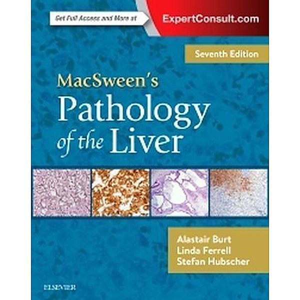 MacSween's Pathology of the Liver, Alastair D. Burt, Linda D. Ferrell, Stefan G. Hubscher