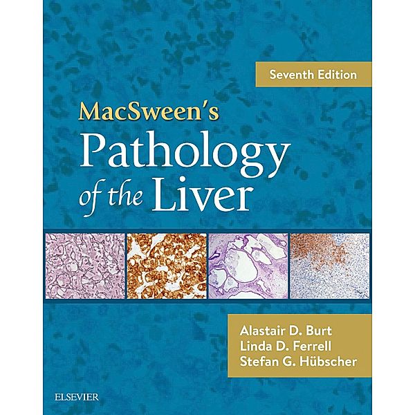 MacSween's Pathology of the Liver E-Book, Alastair D. Burt, Linda D. Ferrell, Stefan G Hubscher