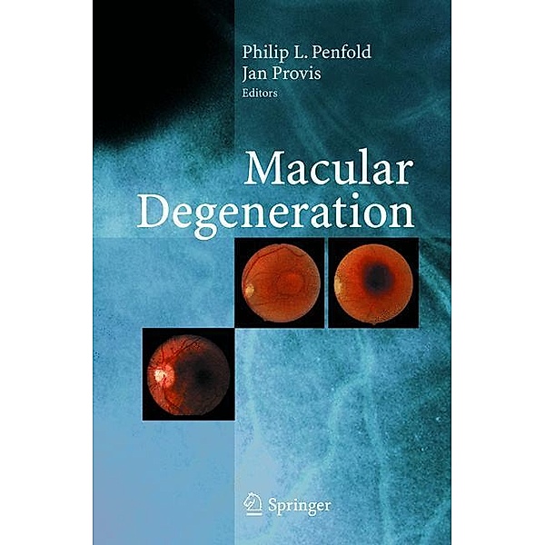 Macular Degeneration, P. L. Penfold, J. Provis
