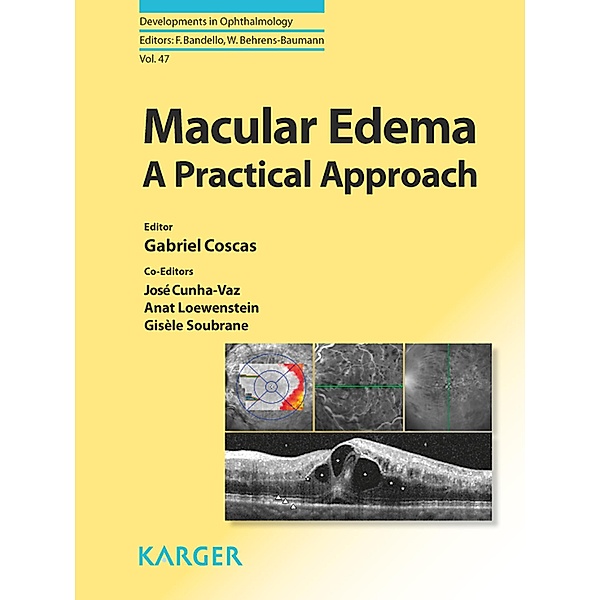 Macular Edema, A. Loewenstein, J. Cunha-Vaz
