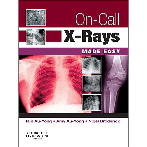 Made Easy: On-Call X-Rays Made Easy E-Book, Amy Au-Yong, Iain Au-Yong, Nigel Broderick