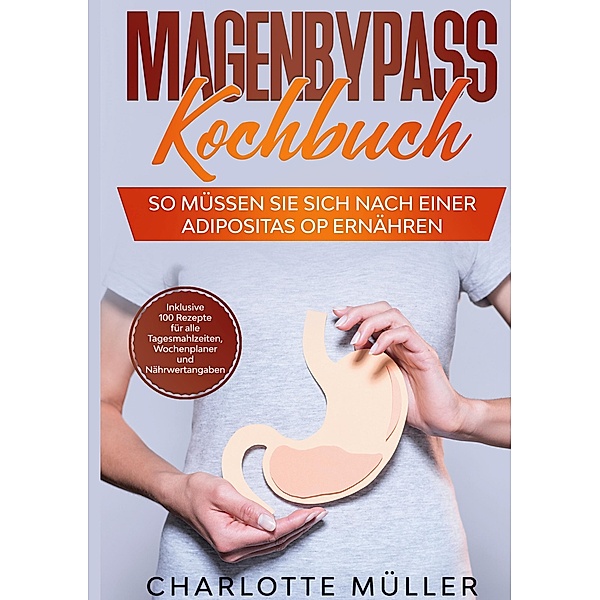 Magenbypass Kochbuch, Charlotte Müller