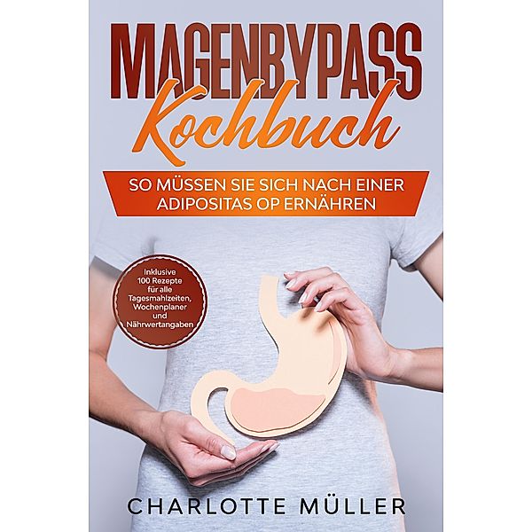 Magenbypass Kochbuch: So müssen Sie sich nach einer Adipositas OP ernähren - Inklusive 100 Rezepte für alle Tagesmahlzeiten, Wochenplaner und Nährwertangaben, Charlotte Müller