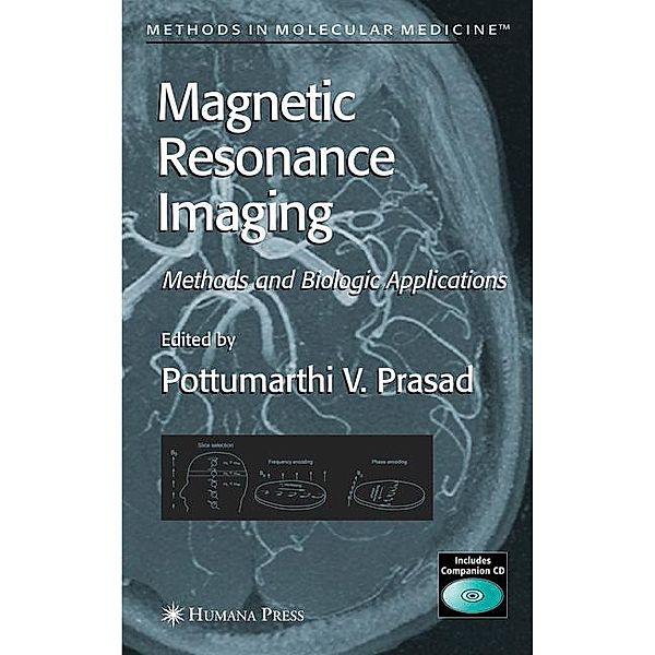 Magnetic Resonance Imaging, Prasad