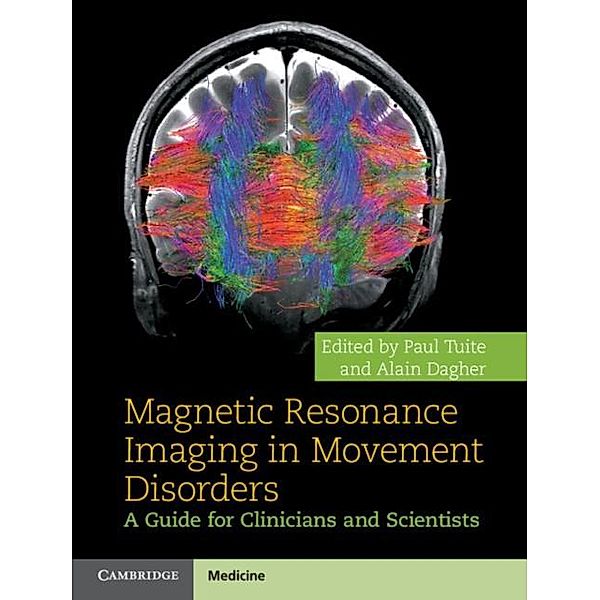 Magnetic Resonance Imaging in Movement Disorders