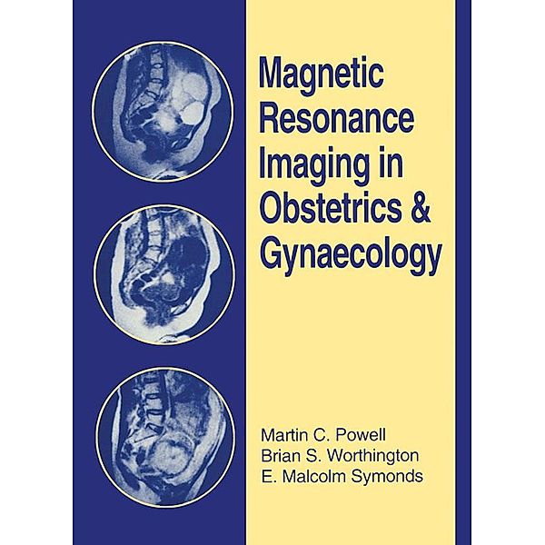 Magnetic Resonance Imaging in Obstetrics and Gynaecology, Martin C. Powell, Brian S. Worthington, E. Malcolm Symonds