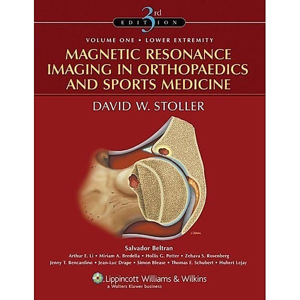 Magnetic Resonance Imaging in Orthopaedics and Sports Medicine, 2 Vols., David W. Stoller