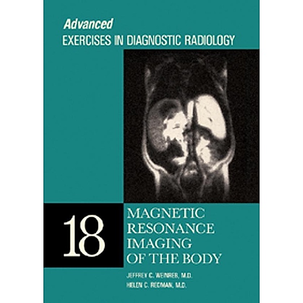 Magnetic Resonance Imaging of the Body, Jeffrey C. Weinreb, Helen C. Redman