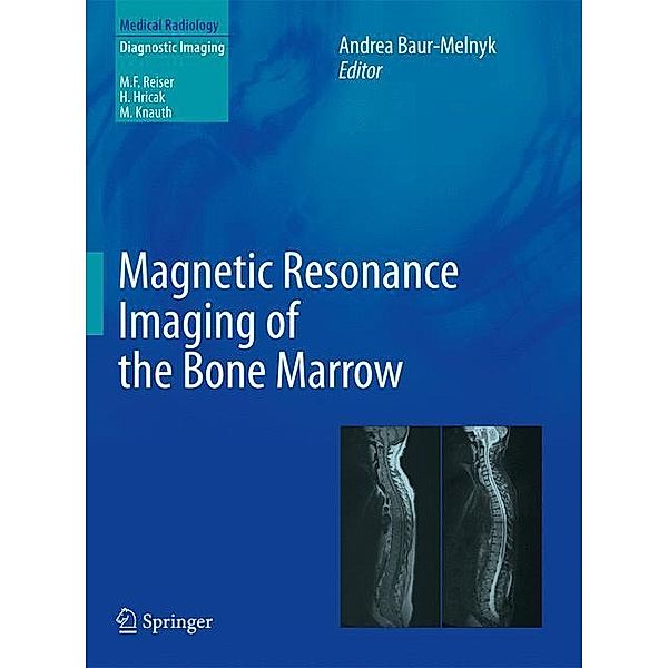 Magnetic Resonance Imaging of the Bone Marrow