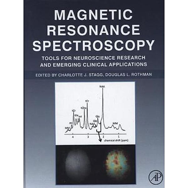 Magnetic Resonance Spectroscopy