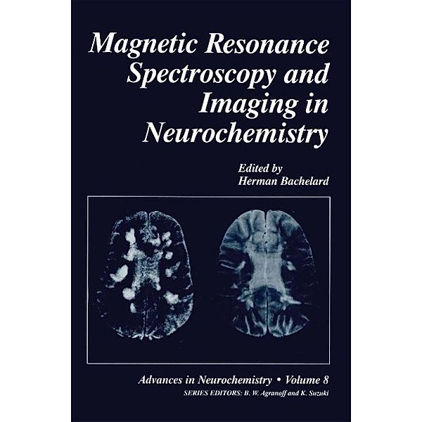 Magnetic Resonance Spectroscopy and Imaging in Neurochemistry / Advances in Neurochemistry Bd.8