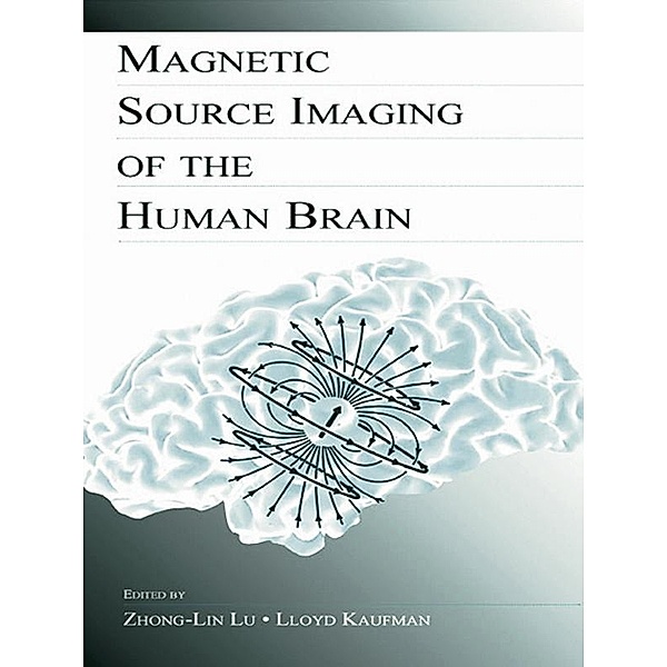 Magnetic Source Imaging of the Human Brain