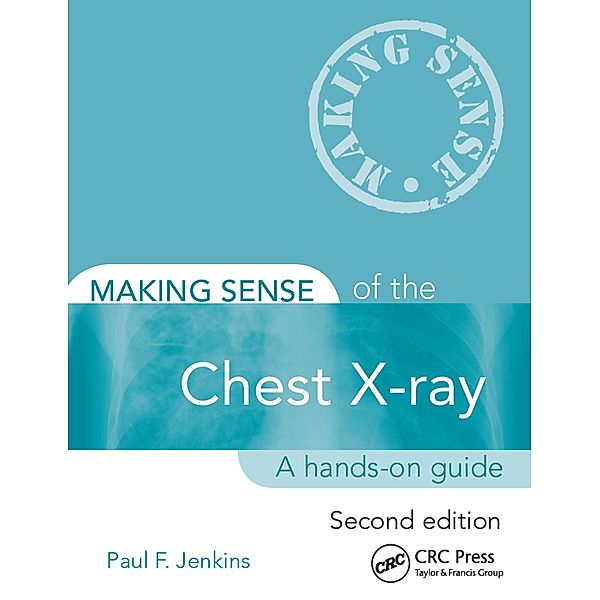 Making Sense of the Chest X-ray, Paul Jenkins