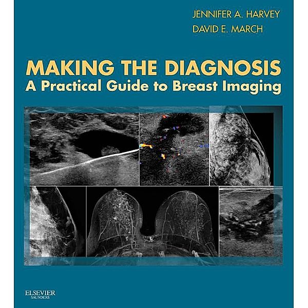 Making the Diagnosis: A Practical Guide to Breast Imaging E-Book, Jennifer Harvey, David E March
