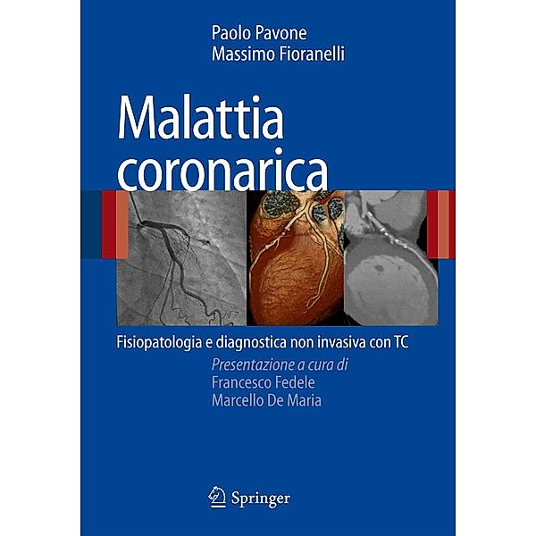 Malattia coronarica, Paolo Pavone, Massimo Fioranelli