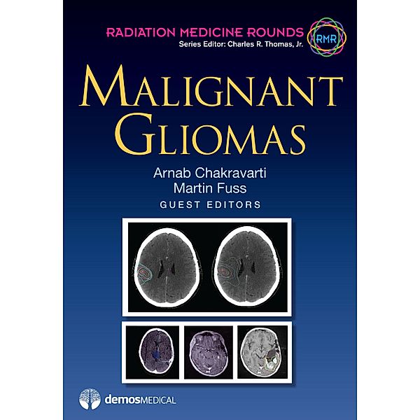 Malignant Gliomas / Radiation Medicine Rounds Bd.Volume 3, Issue 2