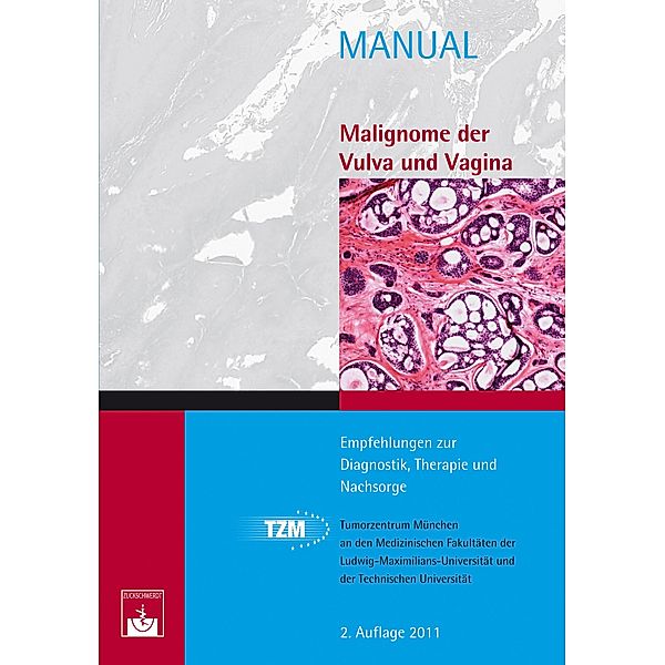 Malignome der Vulva und Vagina / Manuale Tumorzentrum München