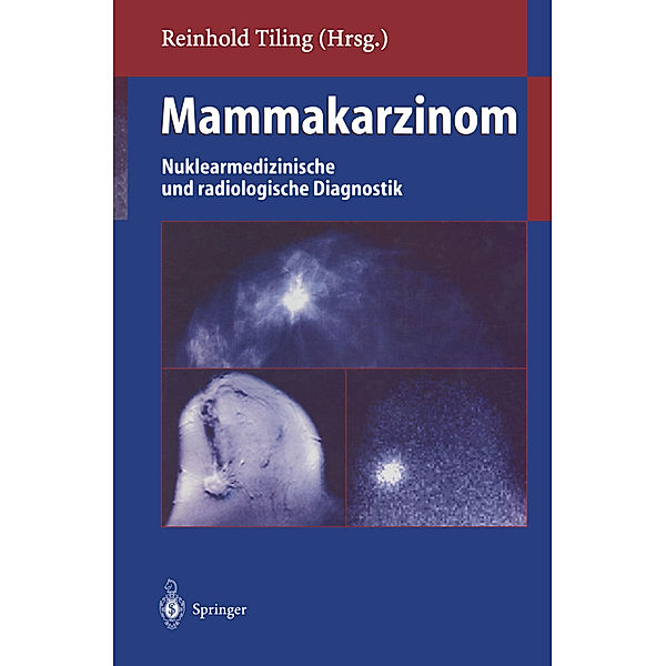 Mammakarzinom