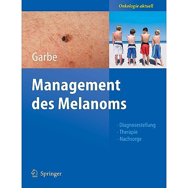 Management des Melanoms / Onkologie aktuell, Claus Garbe