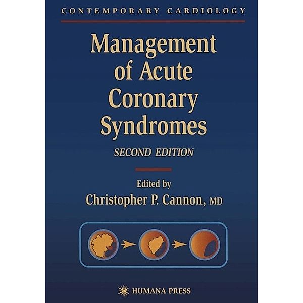 Management of Acute Coronary Syndromes / Contemporary Cardiology