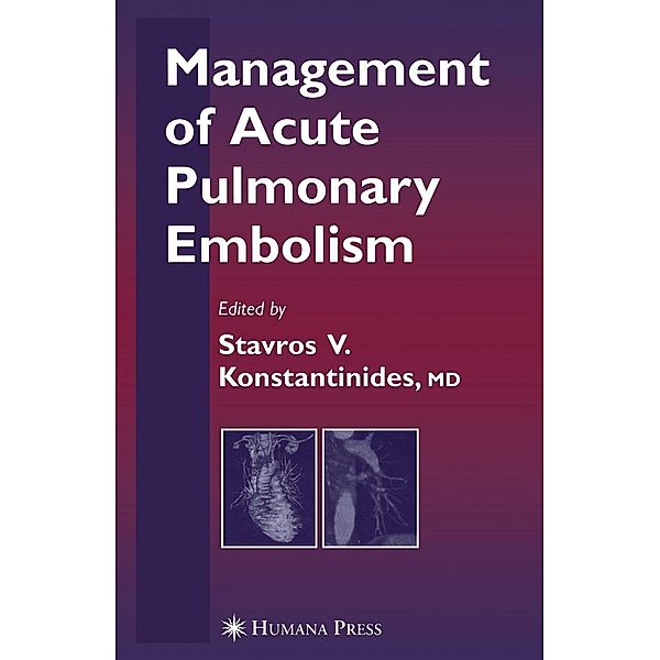 Management of Acute Pulmonary Embolism / Contemporary Cardiology