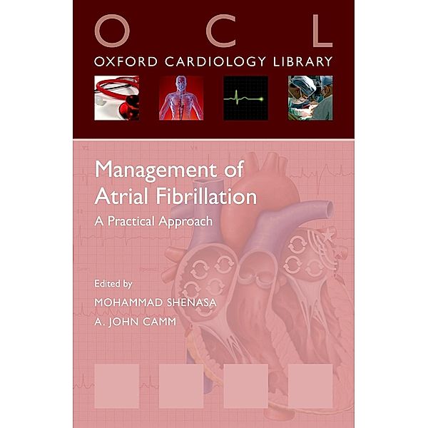 Management of Atrial Fibrillation