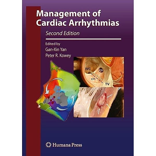 Management of Cardiac Arrhythmias / Contemporary Cardiology