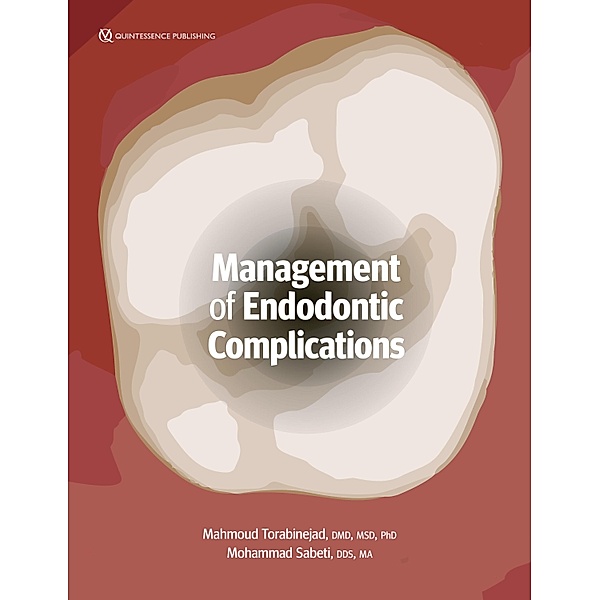 Management of Endodontic Complications, Mahmoud Torabinejad, Mohammad Sabeti