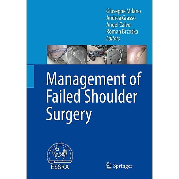 Management of Failed Shoulder Surgery