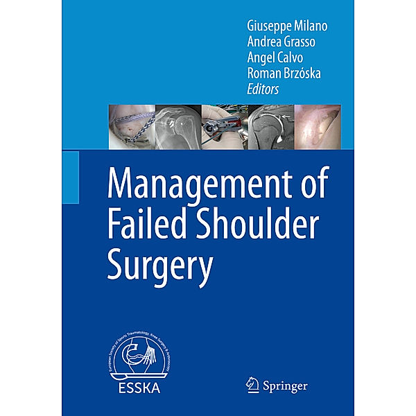 Management of Failed Shoulder Surgery