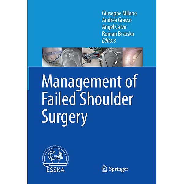 Management of Failed Shoulder Surgery