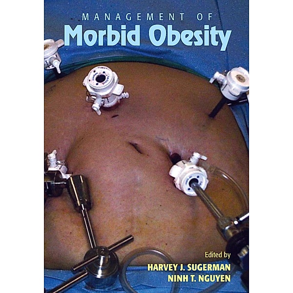Management of Morbid Obesity