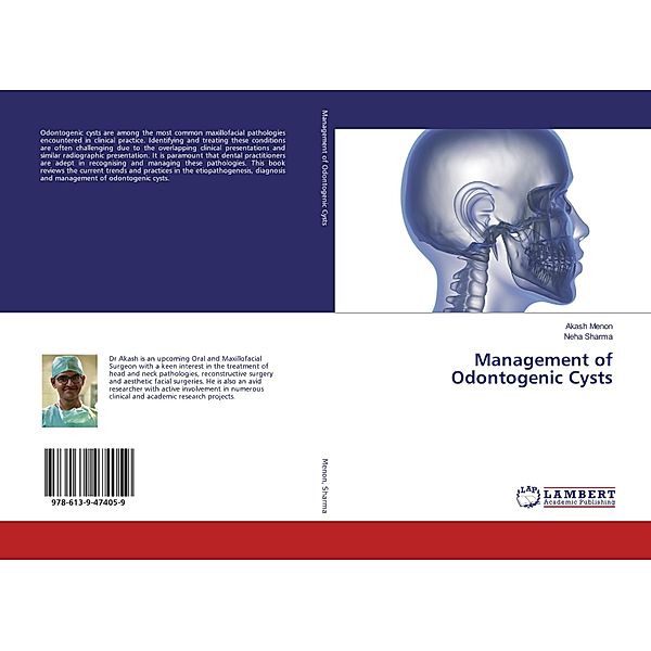 Management of Odontogenic Cysts, Akash Menon, Neha Sharma