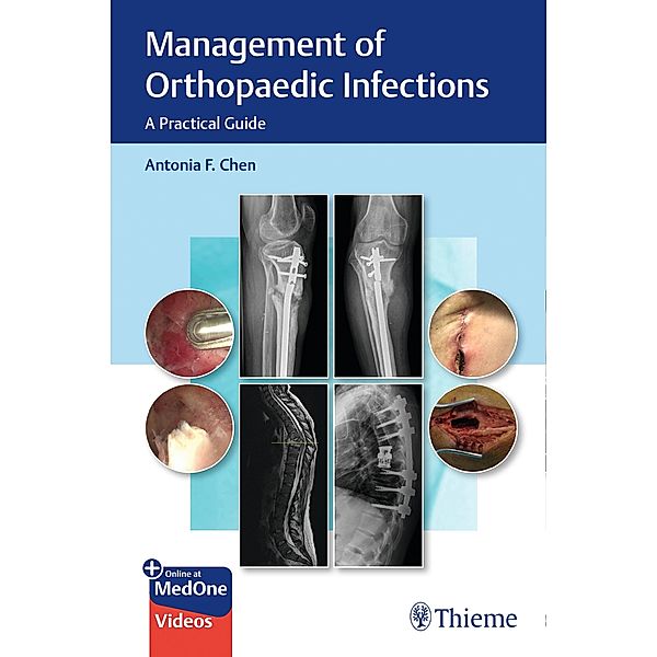 Management of Orthopaedic Infections, Antonia Chen