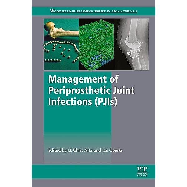 Management of Periprosthetic Joint Infections (PJIs)