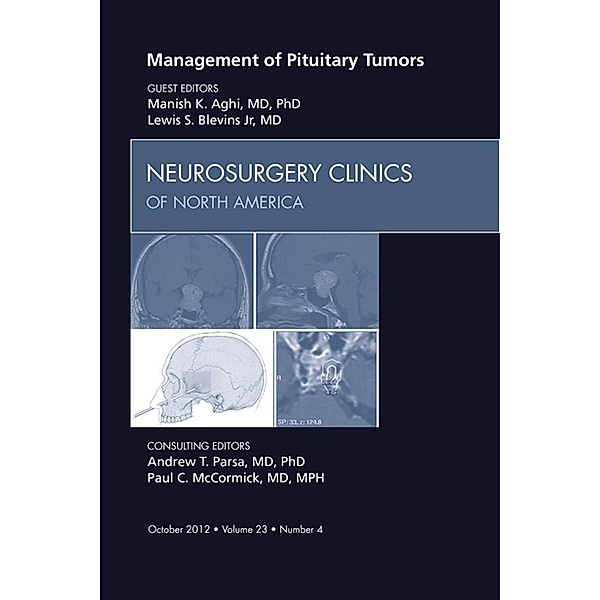 Management of Pituitary Tumors, An Issue of Neurosurgery Clinics, Manish K. Aghi, Lewis S. Blevins