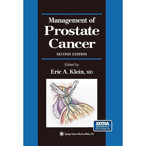 Management of Prostate Cancer / Current Clinical Urology, Eric A. Klein