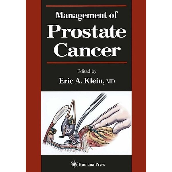 Management of Prostate Cancer / Current Clinical Urology