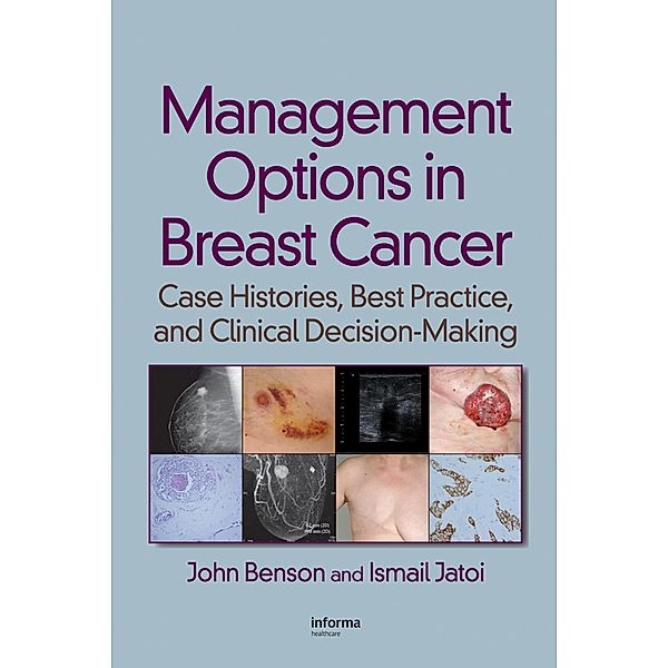 Management Options in Breast Cancer, John Benson, Ismail Jatoi
