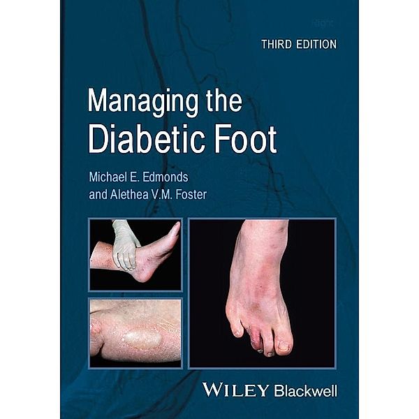 Managing the Diabetic Foot, Michael E. Edmonds, Alethea V. M. Foster