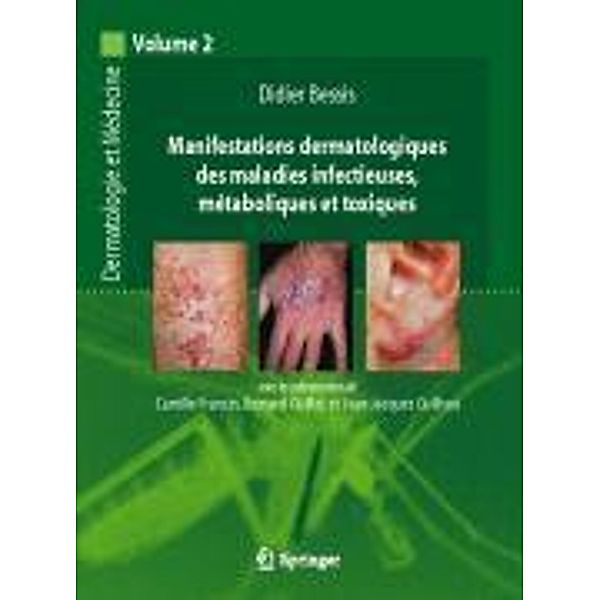 Manifestations dermatologiques des maladies infectieuses, métaboliques et toxiques, Didier Bessis