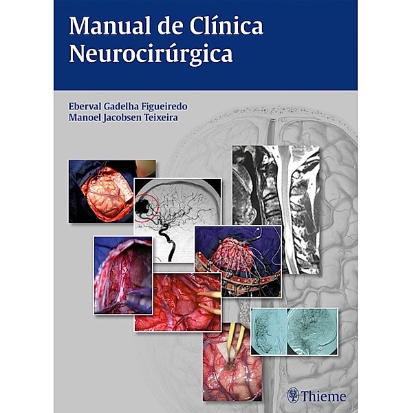 Manual de clínica neurocirúrgica, Gadelha Figueiredo, Jacobsen Teixeira