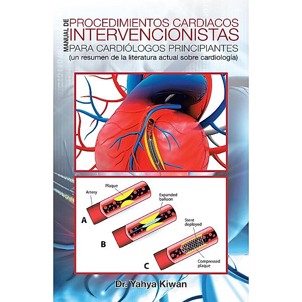 Manual De Procedimientos Cardiacos Intervencionistas Para Cardiólogos Principiantes, Yahya Kiwan