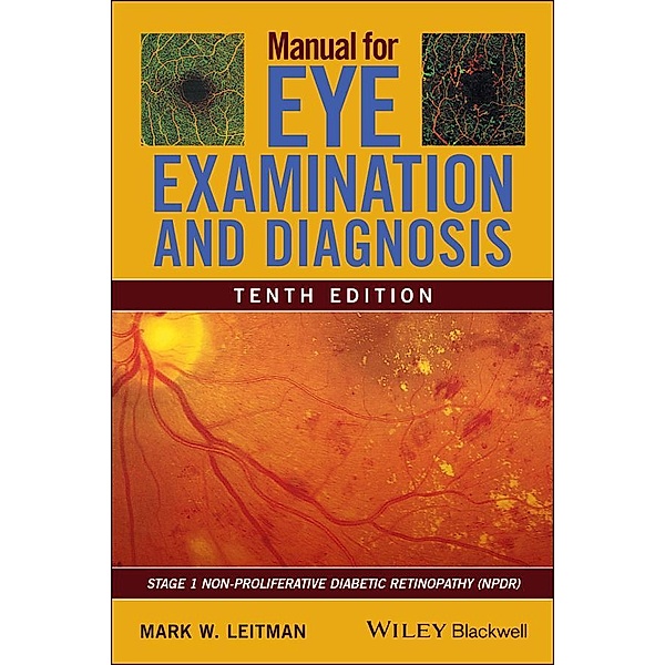 Manual for Eye Examination and Diagnosis, Mark W. Leitman
