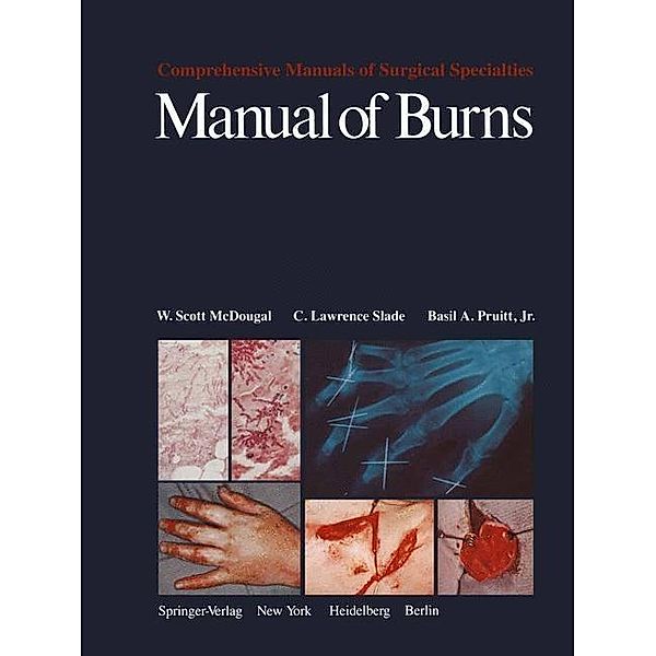 Manual of Burns / Comprehensive Manuals of Surgical Specialties, W. S. McDougal, C. L. Slade, B. A. Jr. Pruitt