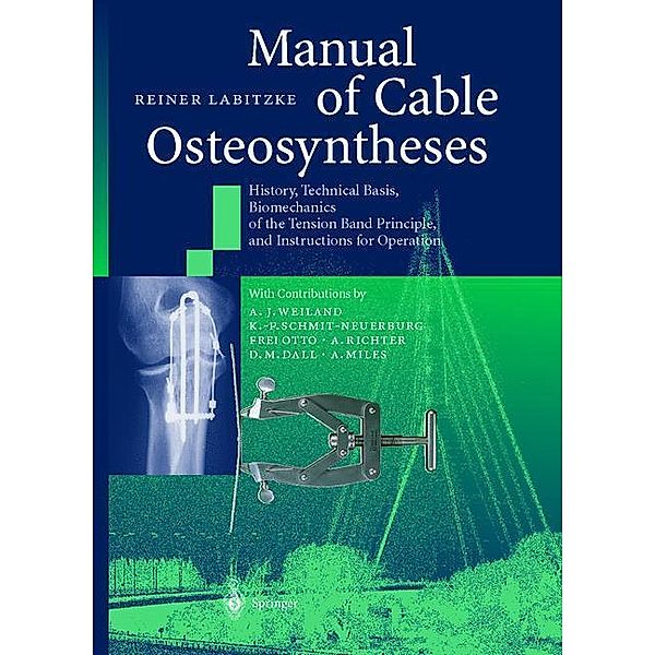 Manual of Cable Osteosyntheses, Reiner Labitzke