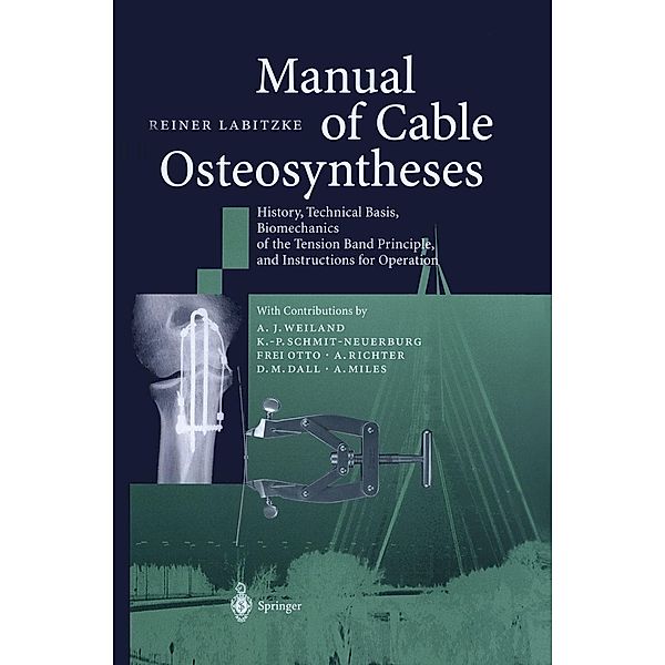 Manual of Cable Osteosyntheses, Reiner Labitzke