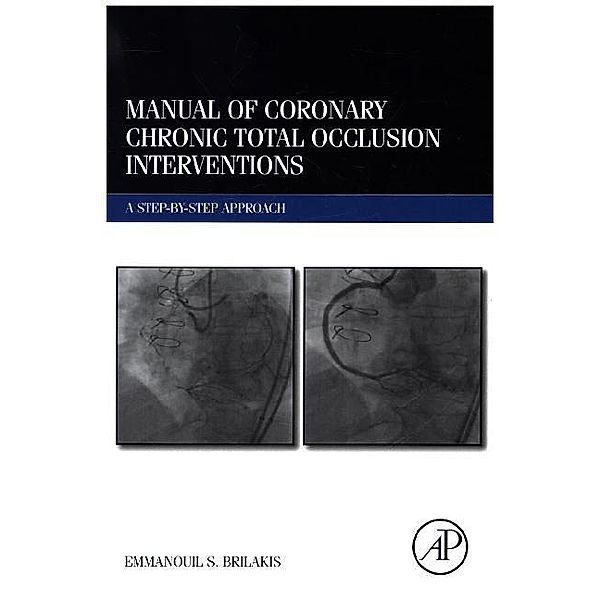 Manual of Coronary Chronic Total Occlusion Interventions, Emmanouil Brilakis