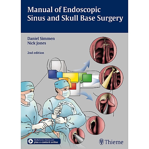 Manual of Endoscopic Sinus and Skull Base Surgery, Daniel Simmen, Nick Jones