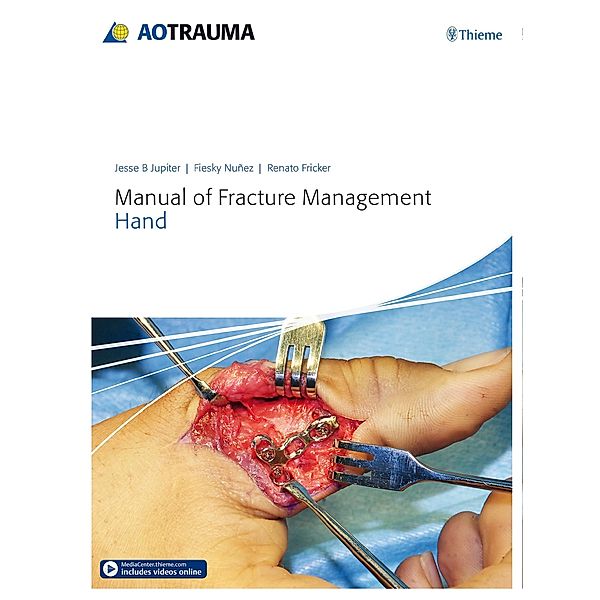 Manual of Fracture Management - Hand